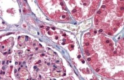 Immunohistochemistry-Paraffin: GFPT1 Antibody [NBP3-14333] - GFPT1 antibody IHC of human kidney. Immunohistochemistry of formalin-fixed, paraffin-embedded tissue after heat-induced antigen retrieval.